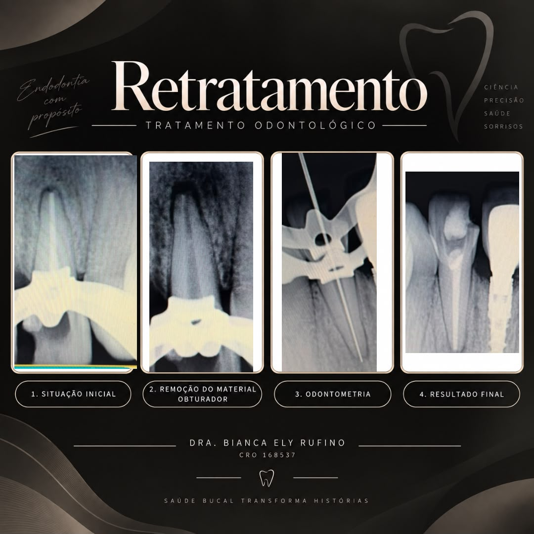 Endodontia