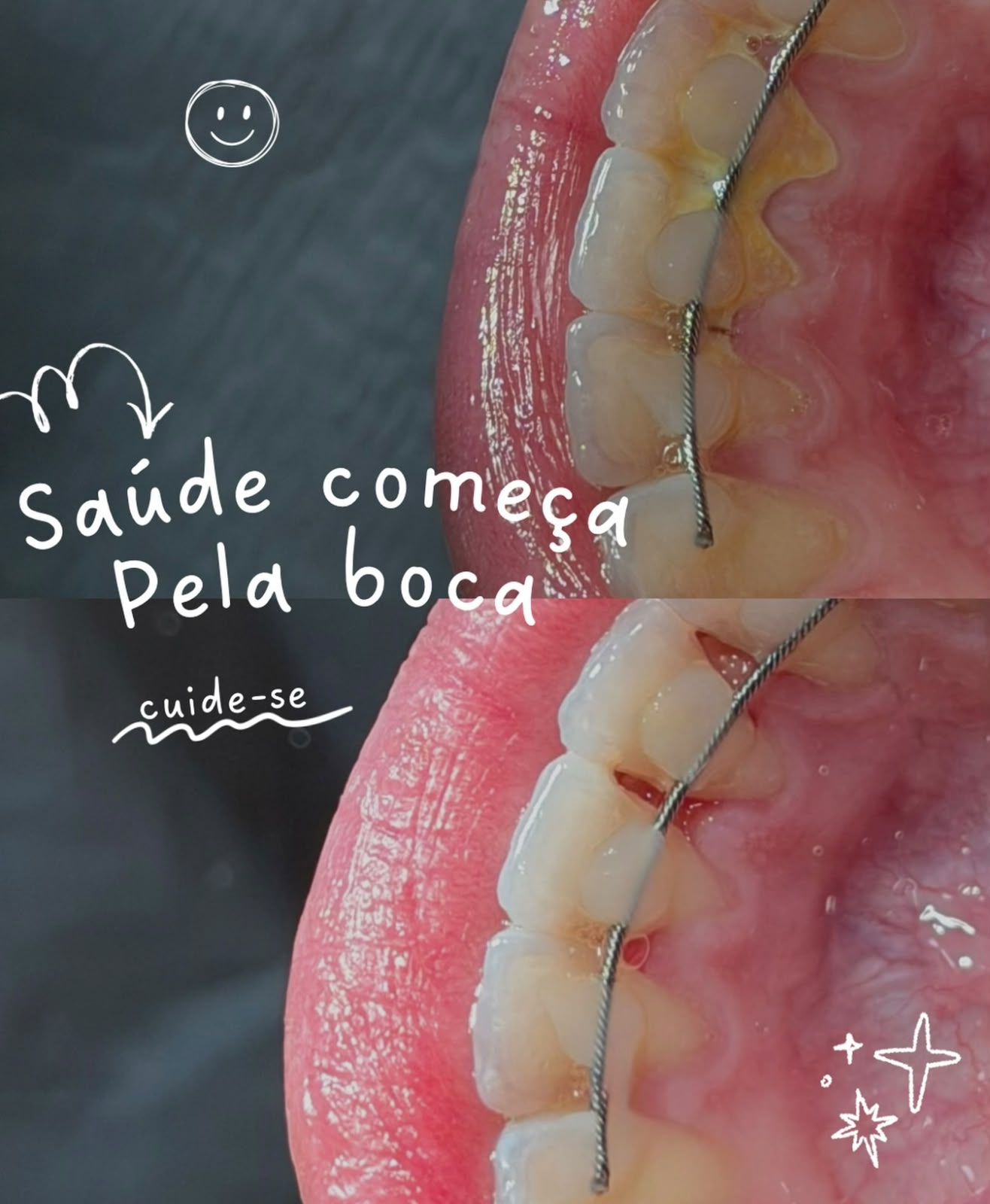Prevenção e saúde bucal
